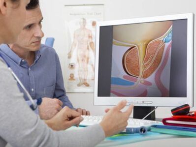 Uroloog konsulteerib patsienti prostatiidi ja selle ravimeetodite osas.